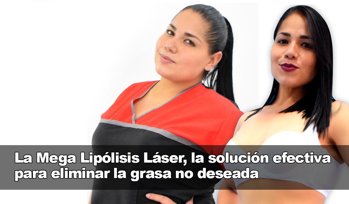 La Mega Lipólisis Láser: sin riesgos al disolver la grasa