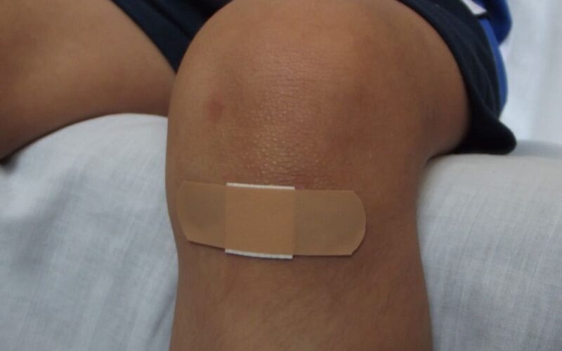 Proveedor confiable de adhesivo tisular en Costa Rica: soluciones para el sector salud