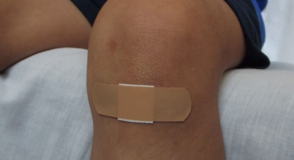 Proveedor confiable de adhesivo tisular en Costa Rica: soluciones para el sector salud